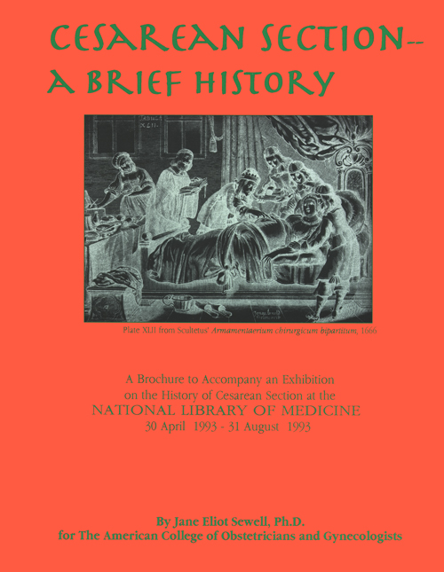 Cesarean Section - A Brief History cover featuring Plate XLII, a physician performing a cesarean section from Johannes Scultetus, Armamentaerium chirurgicum bipartitum.., 1666