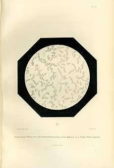 Black and white drawing of yeast cells as seen through a microscope.