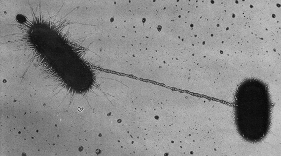 Microphotograph of two E. coli bacteria exchanging DNA through conjugation.  Four views of E. coli bacteria by scanning electron microscope.