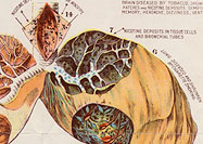 Scientific drawings of the tobacco related diseases effects on the human organs.