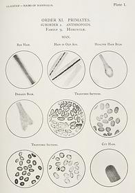 Human hair seen through a microscope, 1931