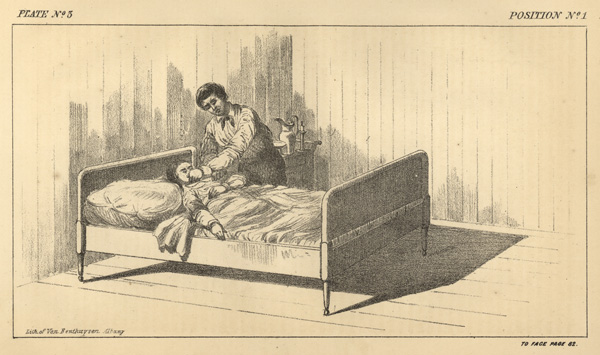 A lithograph of plate number 3, position number 1 of a murder case. A man is standing over the bed while placing his left hand over the mouth of a woman lying in bed, from the right side.